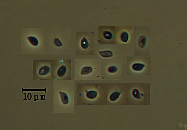 Hyphodontia breviseta (P. Karst.) J. Erikss.